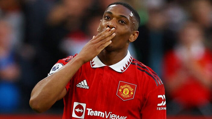 Manchester United'da sakatlanan Anthony Martial, kupa finalinde oynayamayacak