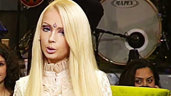 Beyaz Show'a katılmıştı! Ukraynalı Barbie Valeria Lukyanova'nın son hali gündem oldu